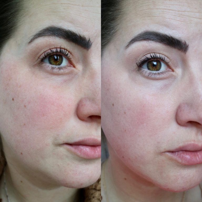 Olay Retinol24 Review I used It everyday for over 30 days these are my results Northern 